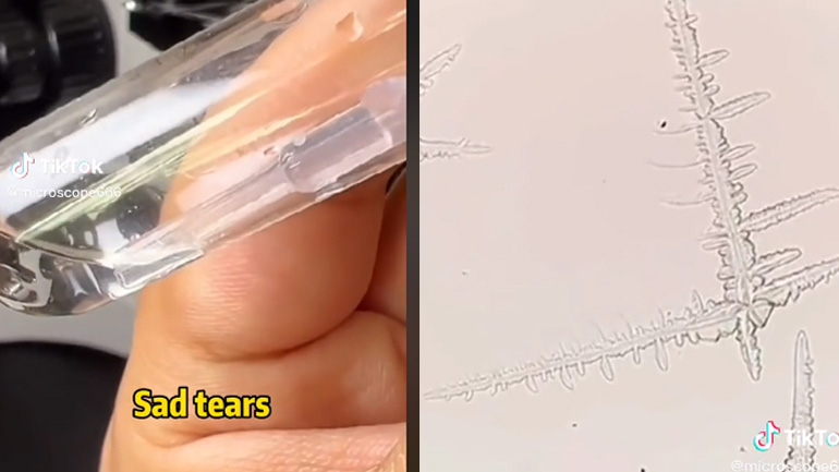 Δάκρυα λύπης μέσα από ένα μικροσκόπιο