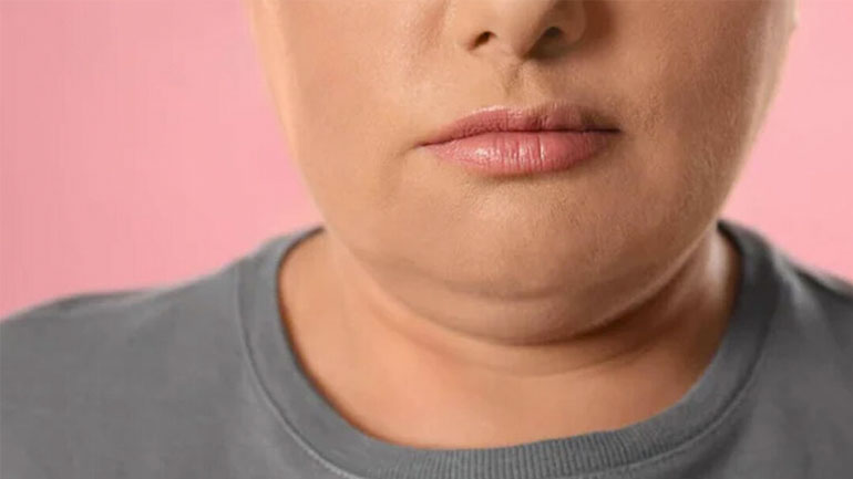 Προγούλι: Τι να κάνετε για να απαλλαγείτε μια και καλή από αυτό