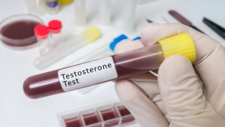 Χαμηλή τεστοστερόνη: Συμπτώματα και διάγνωση