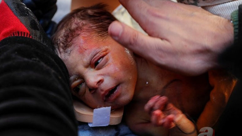 Τουρκία: Συγκλονίζει η διάσωση βρέφους 20 ημερών – Κρατούσε μια τούφα από τα μαλλιά της μητέρας του