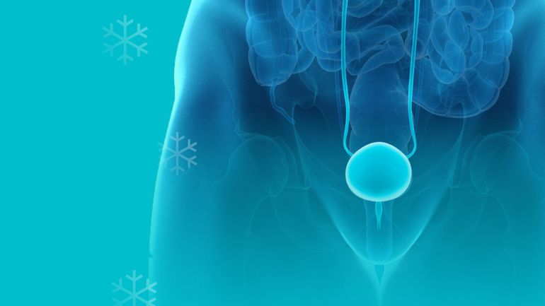 Μπορεί το σεξ να αυξήσει τον κίνδυνο καρκίνου του προστάτη;