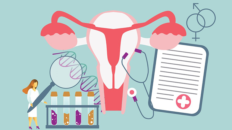 Αδενομύωση: Τι είναι, πώς διαγιγνώσκεται και πώς θεραπεύεται;