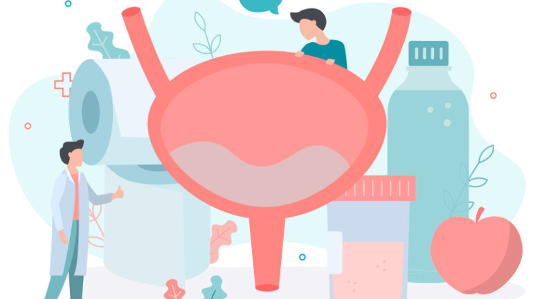 Καρκίνος της ουροδόχου κύστης: Πρόληψη και Θεραπεία