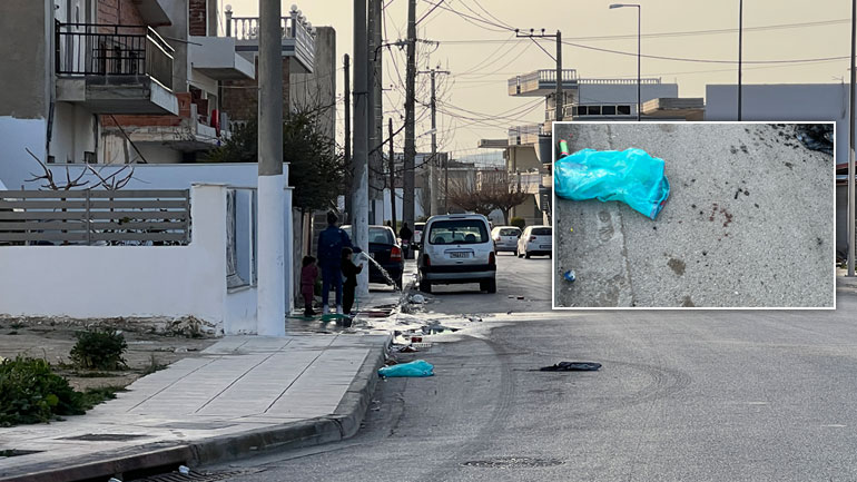 Ζεφύρι: Eσπευμένα στο νοσοκομείο 5χρονο κοριτσάκι μετά από πυροβολισμούς