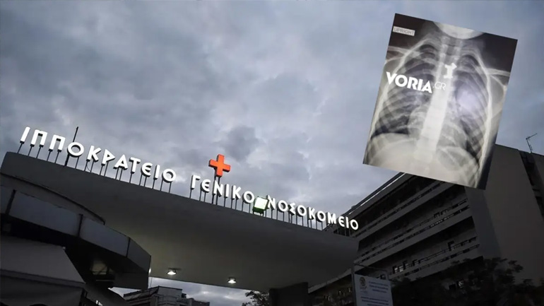 Θεσσαλονίκη: Αγοράκι 4,5 ετών κατάπιε πιόνι επιτραπέζιου – Σωτήρια η επέμβαση στο Ιπποκράτειο