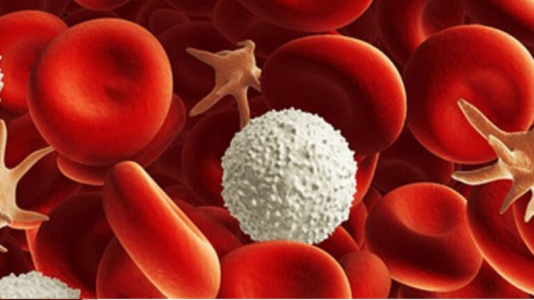 ΜΥΕΛΟΔΥΣΠΛΑΣΤΙΚΑ ΣΥΝΔΡΟΜΑ: Ασθένειες της τρίτης ηλικίας