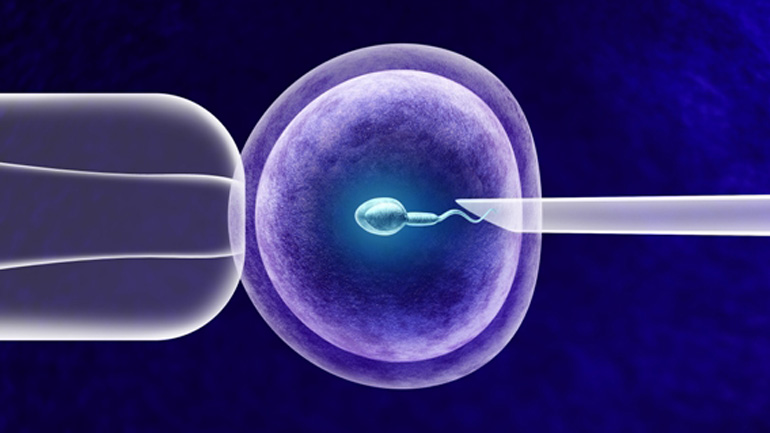 Ποια είναι τα ποσοστά επιτυχίας της εξωσωματικής σε γυναίκες με ενδομητρίωση;