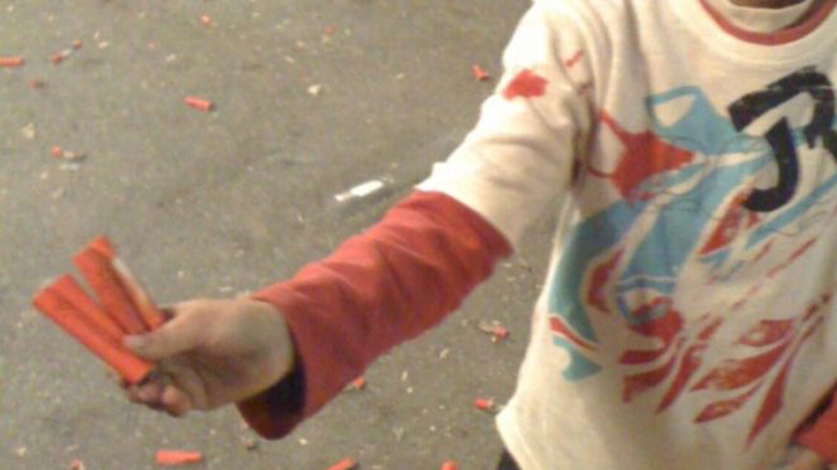 Έσκασε το βεγγαλικό στα χέρια του – Στο Βενιζέλειο νοσοκομείο ένας ανήλικος