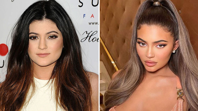 Kylie Jenner: «Δεν είμαι τόσο πλαστική» – Οι αντιδράσεις στα social media για την ατάκα της