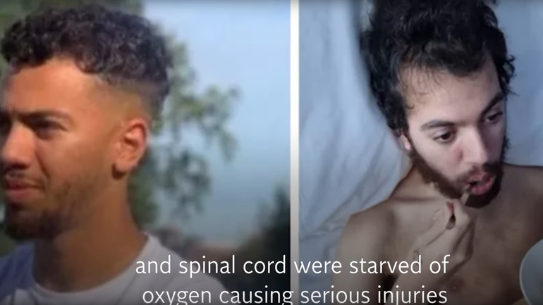 Πρώην ποδοσφαιριστής της Άρσεναλ έχει μείνει τετραπληγικός από νοθευμένο ποτό