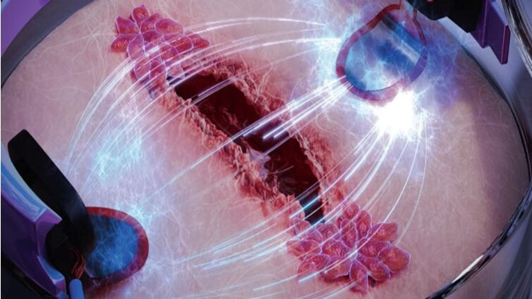 Επιστήμονες επούλωσαν πληγές με τη βοήθεια του ηλεκτρισμού