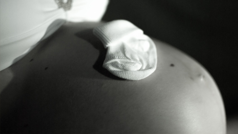 Καρκίνος του μαστού στην εγκυμοσύνη