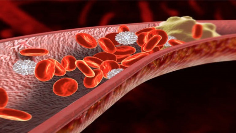 Oι στατίνες βελτιώνουν την υγεία των αιμοφόρων αγγείων