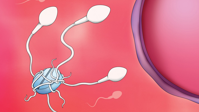 Νέοι ορίζοντες στην ανδρική αντισύλληψη