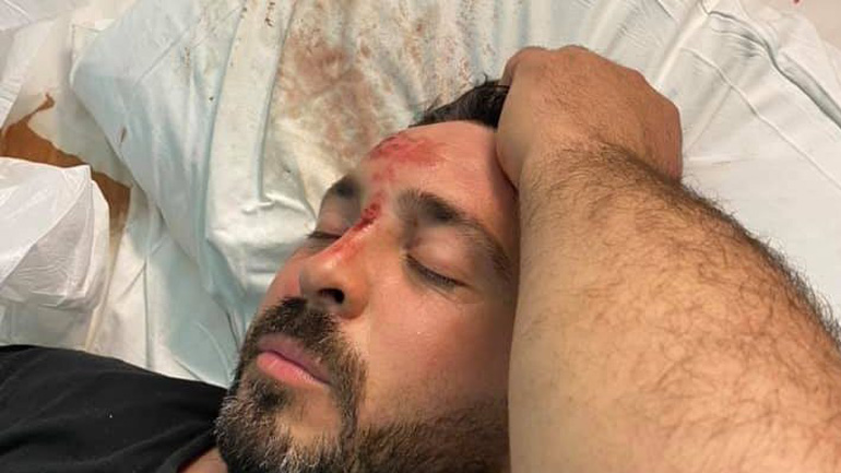 Πάτρα: 7 χρόνια φυλάκιση στον κούριερ που προσπάθησε να σκοτώσει επιχειρηματία