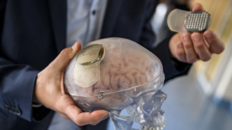 Η εταιρεία εγκεφαλικών εμφυτευμάτων (τσιπάκια) του Ελον Μασκ πήρε άδεια για πειράματα σε ανθρώπους