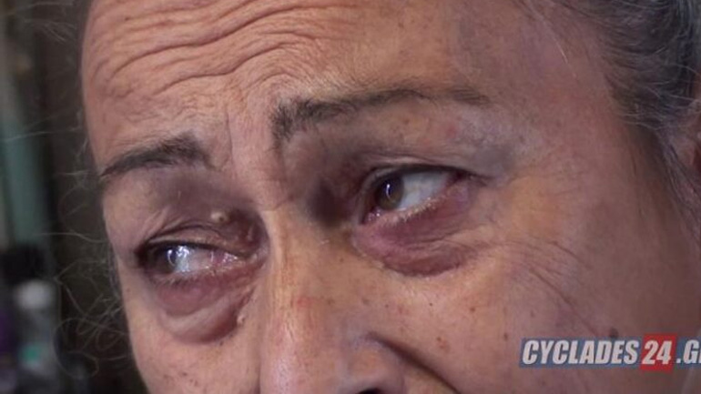 Ντροπή: Ανήλικος γρονθοκόπησε τετραπληγική γυναίκα, καθηλωμένη σε αναπηρικό αμαξίδιο