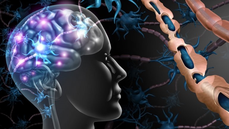 Η εγκυμοσύνη μπορεί να βοηθά στη σκλήρυνση κατά πλάκας