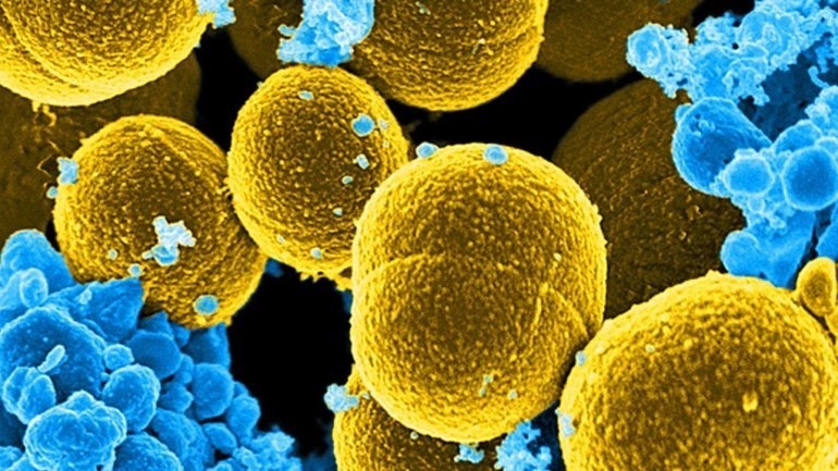 ΠΙΣ: Οι στρεπτοκοκκικές λοιμώξεις δεν συνιστούν επιδημία