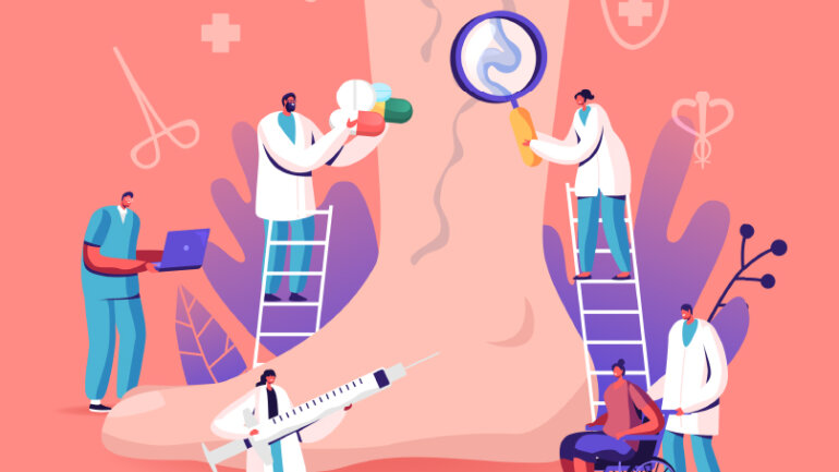 Κιρσοί κάτω άκρων: Τι «δείχνουν» και τι «κρύβουν»