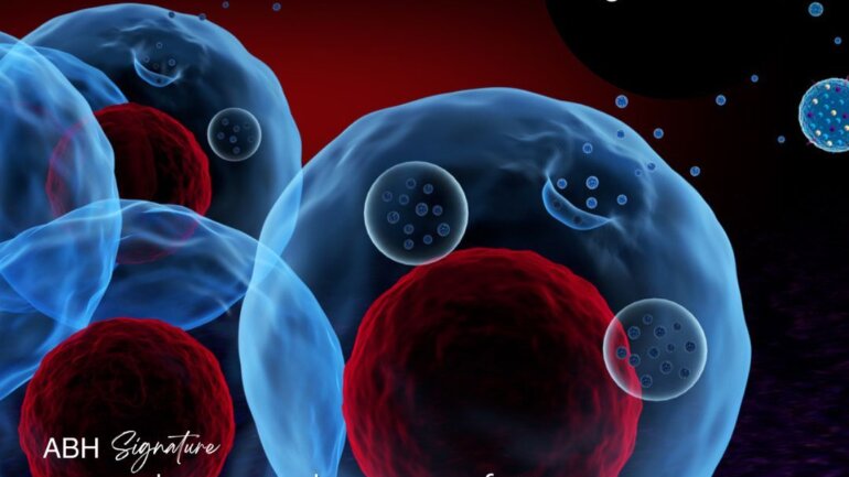 Exelixir: Η πρώτη θεραπεία με Exosomes στην Ελλάδα από τον Όμιλο ΑΒΗ Medical Group