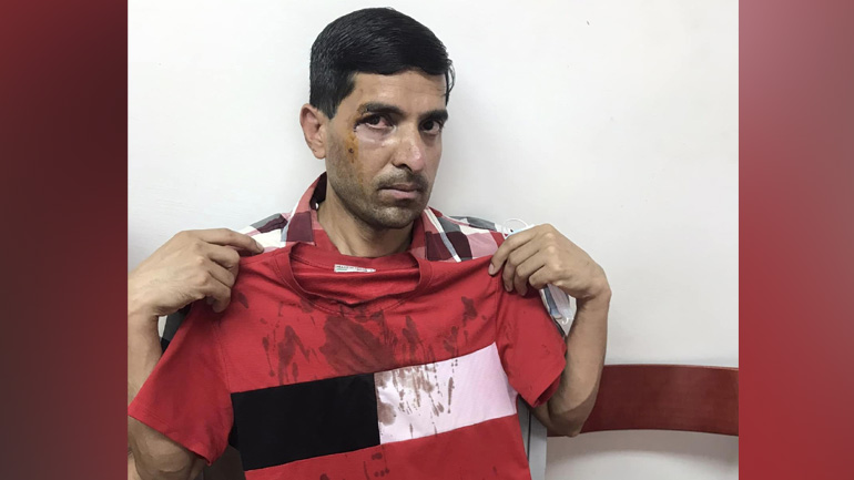 Καταγγελία για άγριο ξυλοδαρμό δύο μεταναστών σε Περιστέρι και Σεπόλια