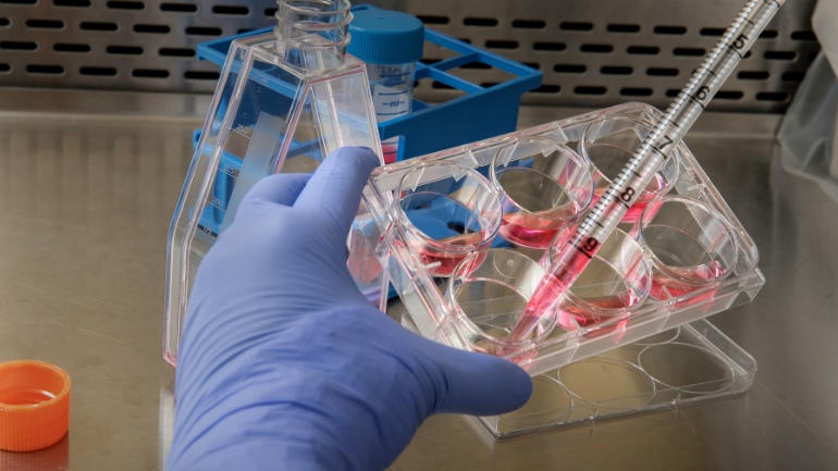 Σε κατάσταση υγειονομικής έκτακτης ανάγκης το Περού, λόγω έξαρσης του συνδρόμου Γκιγέν-Μπαρέ