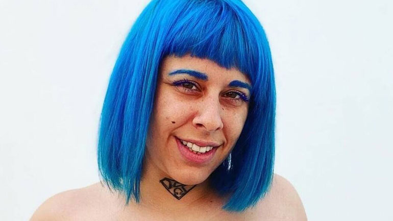 Super Κική: H ανάρτηση με αναπηρικό καροτσάκι μετά το χειρουργείο για αφαίρεση λίπους