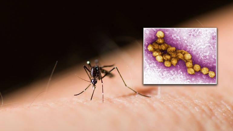 Διαγνώστηκε στις Σέρρες το πρώτο περιστατικό λοίμωξης από τον ιό του Δυτικού Νείλου