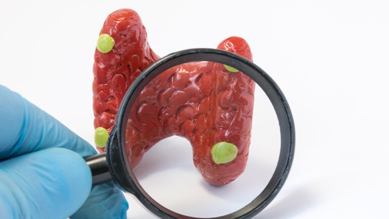 Τι συμβαίνει στον οργανισμό όταν «αρρωσταίνουν» οι παραθυρεοειδείς αδένες;