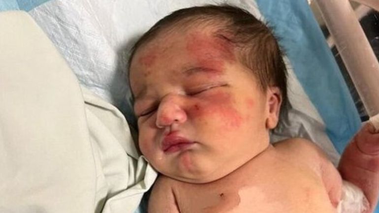 Αδέσποτος σκύλος έσωσε εγκαταλελειμμένο νεογέννητο στο Λίβανο