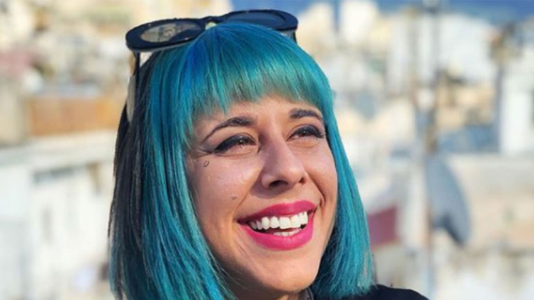 Η Super Κική ποζάρει χωρίς ρούχα μετά τη λιποαναρρόφηση