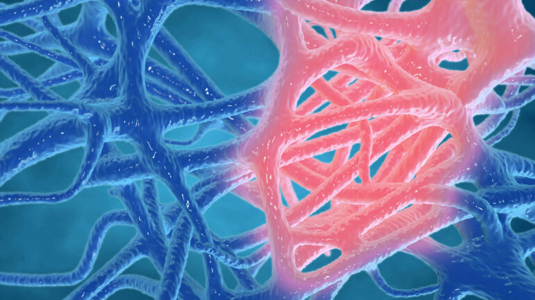 Ανακάλυψη για τη φλεγμονή θα μπορούσε να επιβραδύνει τη γήρανση