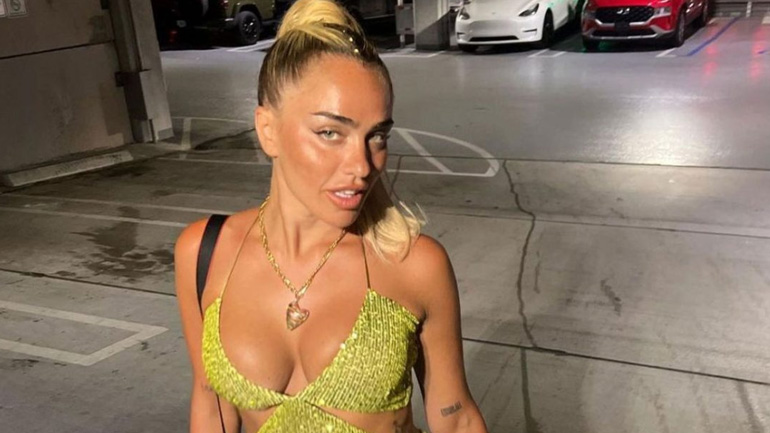 Κόνι Μεταξά: To «ατύχημα» στις διακοπές της στην Κρήτη