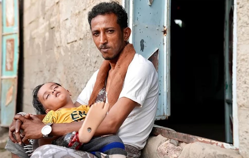 Ο Αμίρ «θυμάται κάθε στιγμή» μετά τον βομβαρδισμό που του πήρε το πόδι, λέει ο πατέρας του