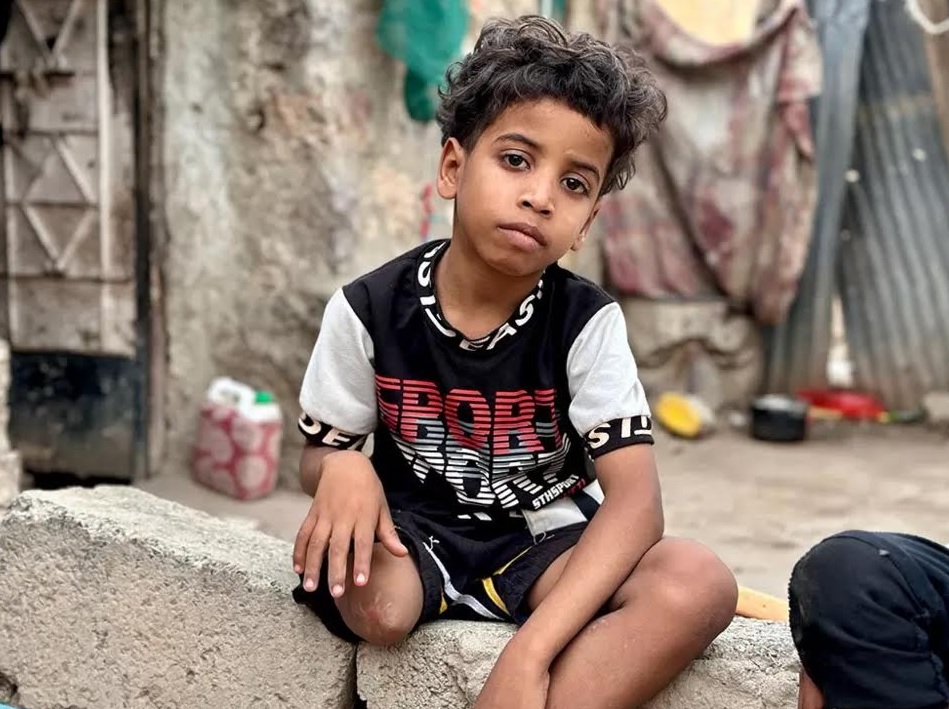 Ο Μπάνετρ έχασε μέρος του δεξιού του ποδιού όταν χτυπήθηκε από μια οβίδα καθώς επέστρεφε από το σχολείο