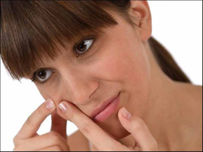 Η ακμή δεν σταματάει στην εφηβεία!