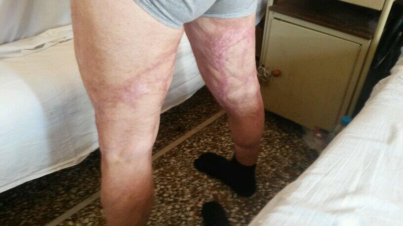 180 ΑΠΕΡΓΟΙ ΚΡΑΤΟΥΜΕΝΟΙ ΚΑΡΚΙΝΟΠΑΘΕΙΣ,ΝΕΦΡΟΠΑΘΕΙΣ,ΜΕΤΑΜΟΣΧΕΥΜΕΝΟΙ,ΟΡΟΘΕΤΙΚΟΙ ΣΑΠΙΖΟΥΝ ΣΤΟ ΚΟΛΑΣΤΗΡΙΟ ΝΟΣΟΚΟΜΕΙΟ ΚΡΑΤΟΥΜΕΝΩΝ