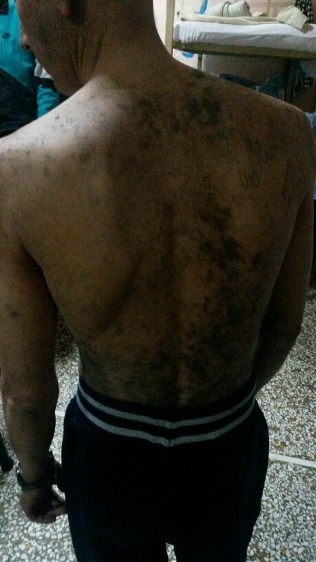 ΒΟΗΘΗΣΤΕ ΜΑΣ ΔΙΑΔΩΣΤΕ ΤΟ ΠΑΝΤΟΥ ΚΙΝΔΥΝΟΣ ΕΞΑΠΛΩΣΗΣ ΦΥΜΑΤΙΩΣΗΣ ΨΩΡΑΣ ΣΤΟ ΚΟΛΑΣΤΗΡΙΟ ΝΟΣΟΚΟΜΕΙΟ ΚΡΑΤΟΥΜΕΝΩΝ ΚΟΡΥΔΑΛΛΟΥ 