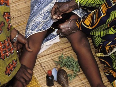 Unicef: 30 εκατ. κορίτσια κινδυνεύουν με ακρωτηριασμό των γεννητικών τους οργάνων