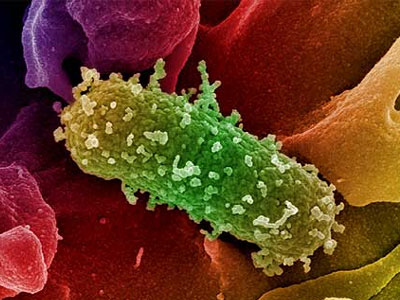 SEXUALITY: Στην ανάλυση σπέρματος μου βρήκαν E.Coli. Τι να κάνω;