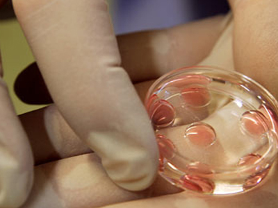 Γονιμότητα: Εξωσωματική γονιμοποίηση με φυσικό κύκλο