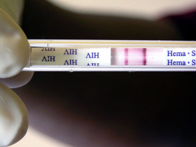 Γονιμότητα: Παγκόσμια Ημέρα για το AIDS: Κάντε κι εσείς το τεστ