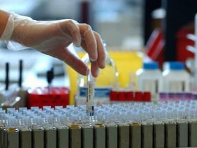 SEXUALITY: Το ύπουλο σύμπτωμα της αιματουρίας