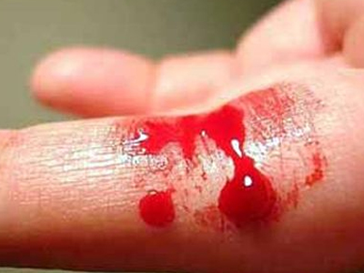 Παγκόσμια Ημέρα Αιμορροφιλίας