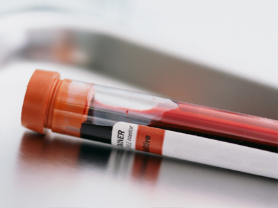 SEXUALITY: Αυξάνονται οι καρκίνοι που σχετίζονται με τον HPV