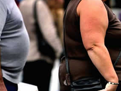 Παχυσαρκία και ψωρίαση