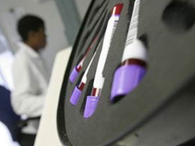 Γεννήθηκε το εκατομμυριοστό βρέφος χωρίς AIDS