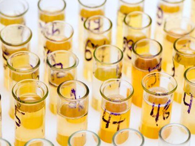 Τεστ και καρκίνος της ουροδόχου κύστης