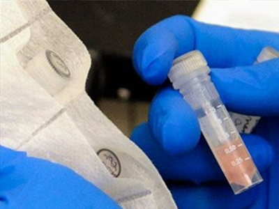 ΗΠΑ: Στους 23 οι νεκροί από το ξέσπασμα μηνιγγίτιδας